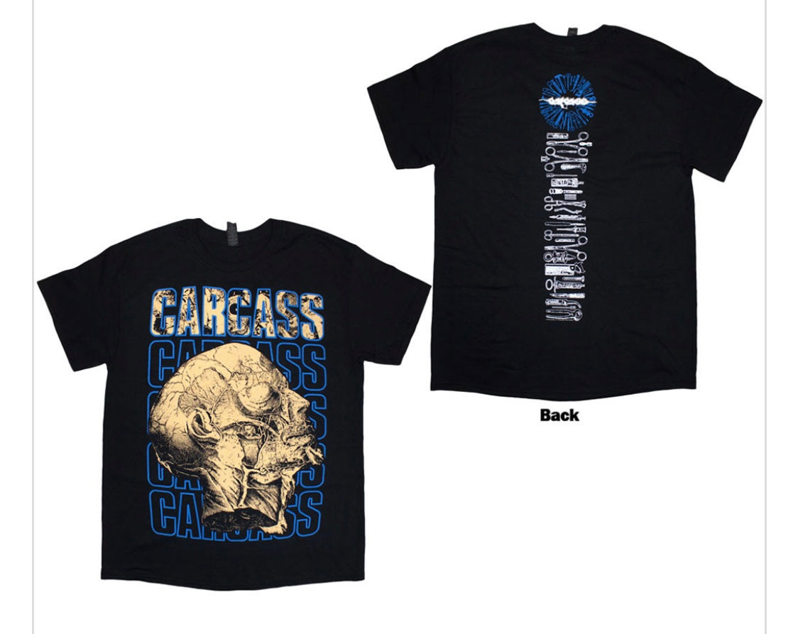 Carcass